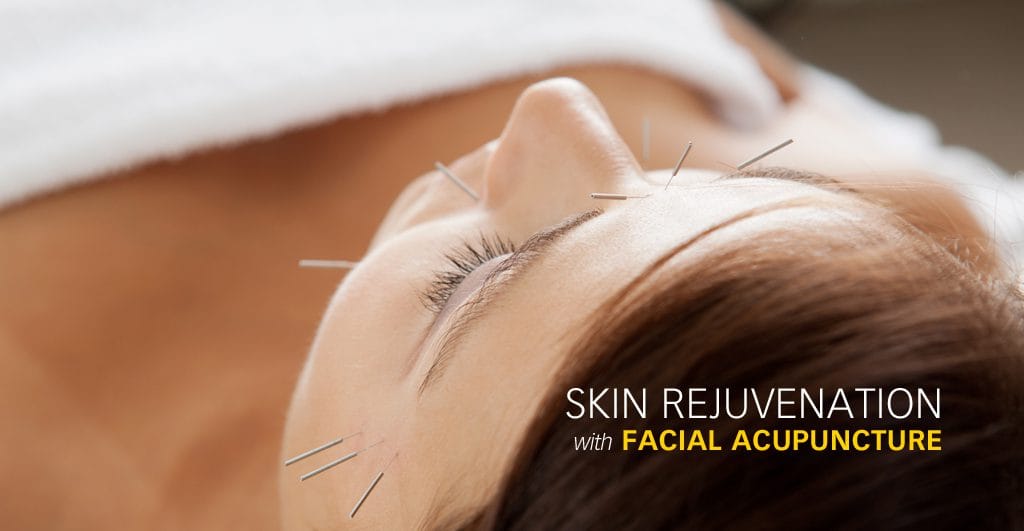 Facial Acupuncture