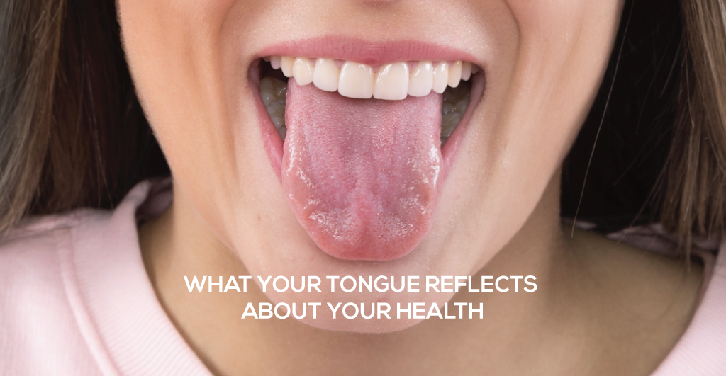Your Tongue Reflects Your Health