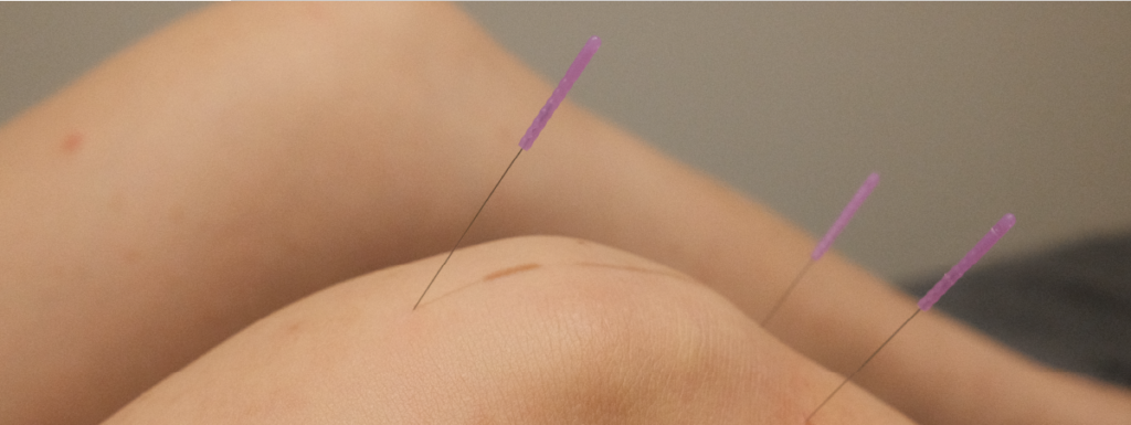 acupuncture on the knee