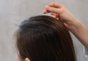 acupuncture on the head