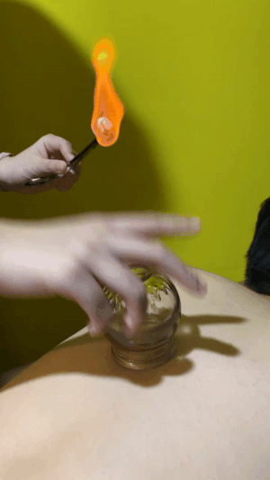 Cupping_How_it_enhances_recovery_and_sports_performance_2