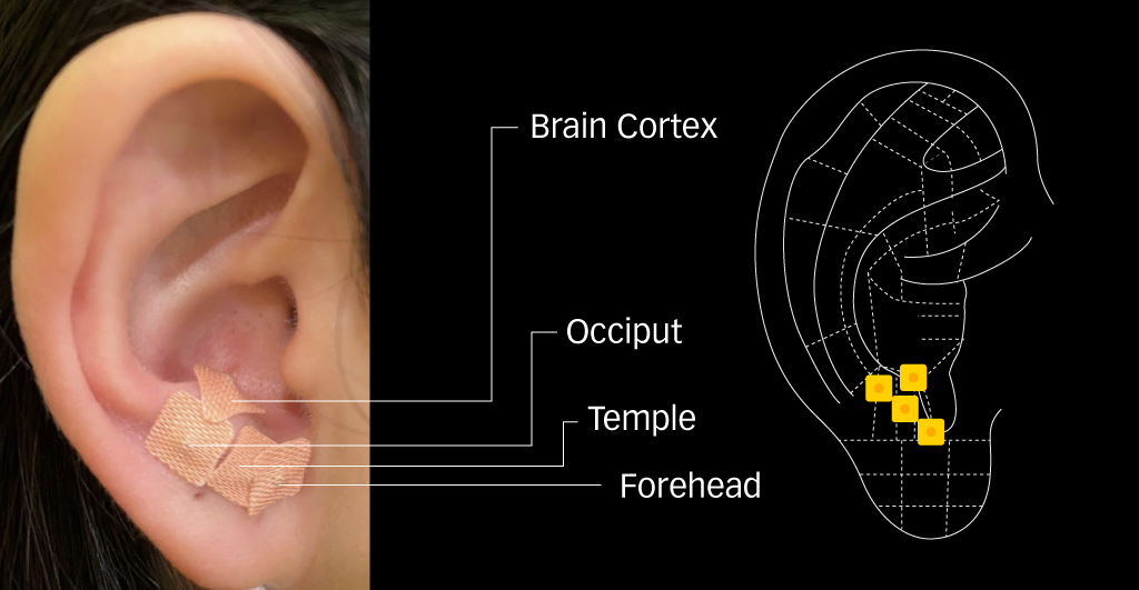 Auricular_Acupressure_4