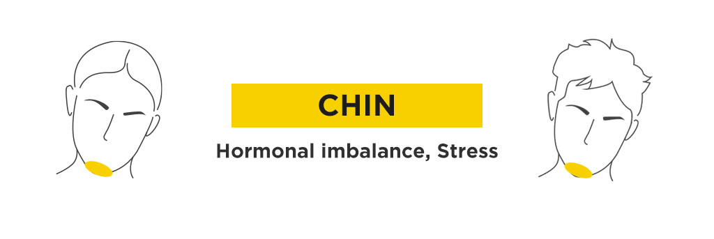 What is the TCM Acne Mapping for Chin and Jawline Acne