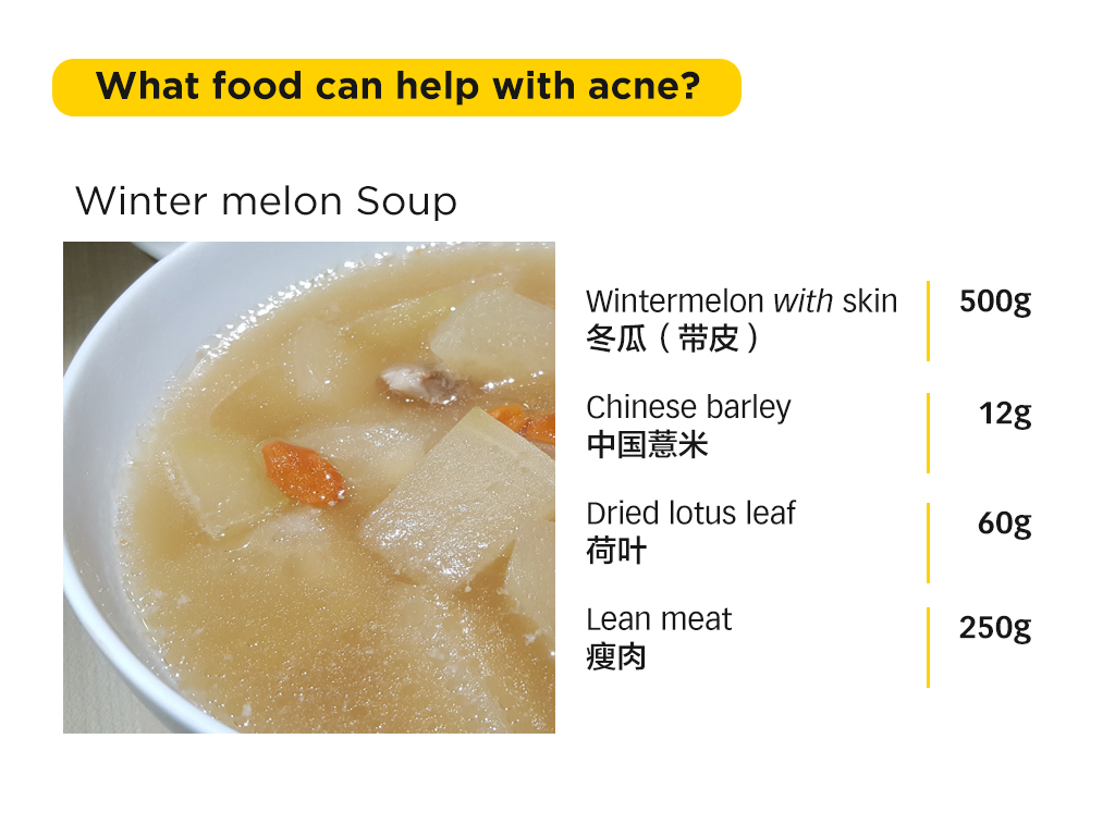 TCM perspective How certain foods can cause acne 3