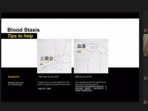 A TCM Approach To Boosting Immunity