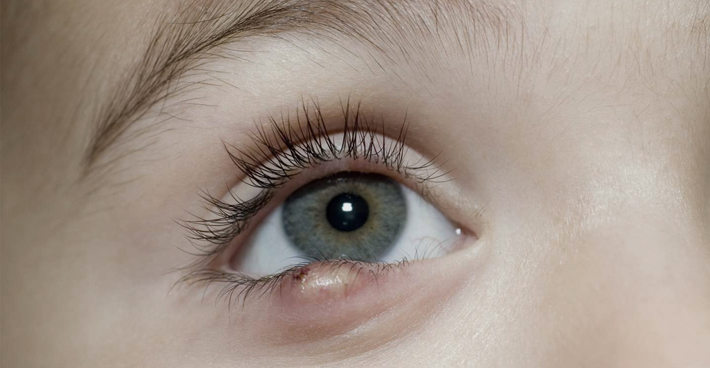 Managing styes: How can TCM help?