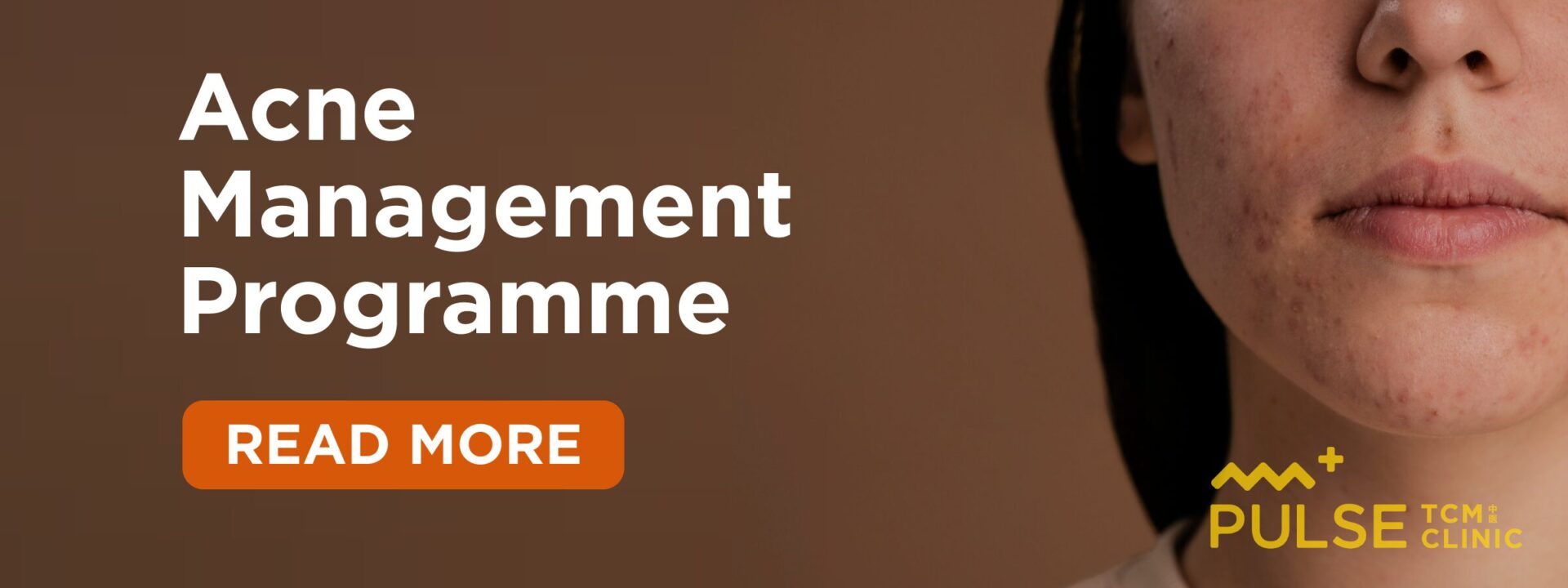 banner of pulse acne program