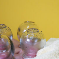 cupping therapy